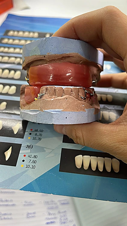 Mano sosteniendo un modelo dental frente a una guía de colores de dientes